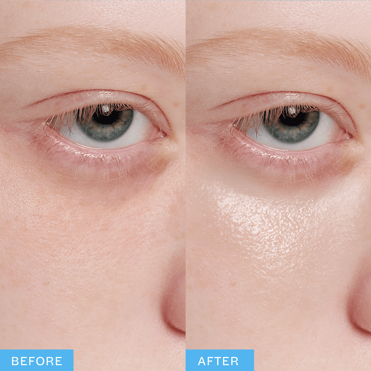 Blue Peptide Eye Patch